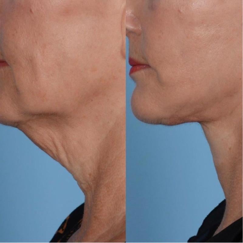 ๐ #1 Neck Firming Solution! ๐ Nourishing Neck Care Stick