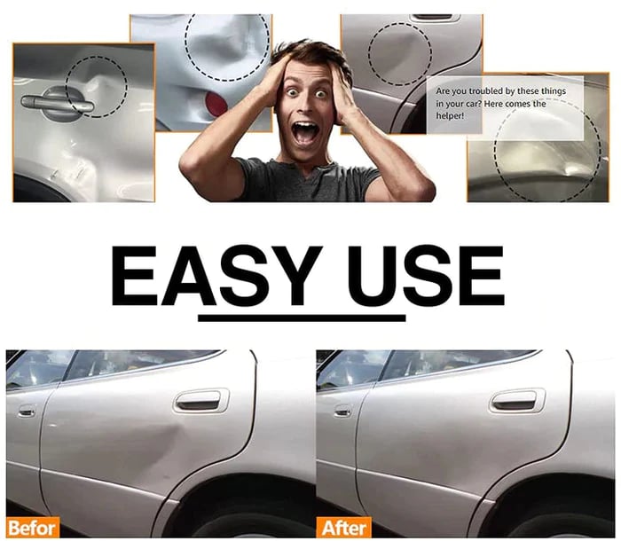 aakip™-🔥Hot Sale 49% OFF🔥Car Dent Remover