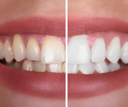 aakip™-New V34 Series Toothpaste Purple Color Corrector